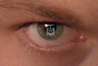 A close-up of a human eye with a small square sticker or patch applied over the iris, showing a black-and-white face graphic.